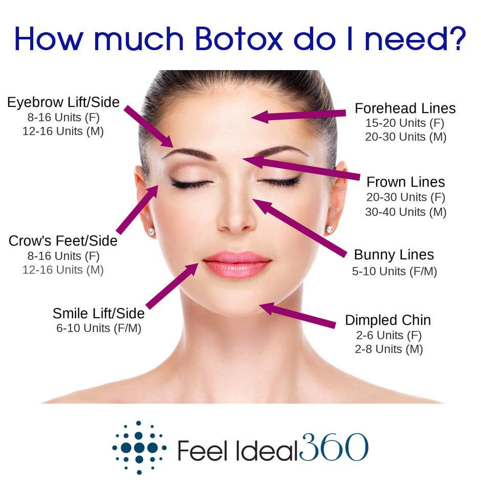 How Much Botox Do I Need? Feel Ideal 360 Southlake
