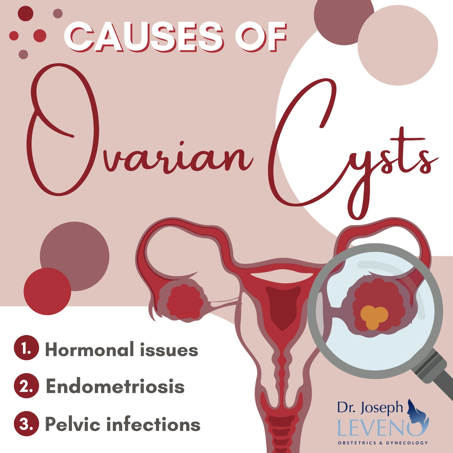 Causes-Of-Ovarian-Cysts-Women's-Health - Dr. Joseph Leveno