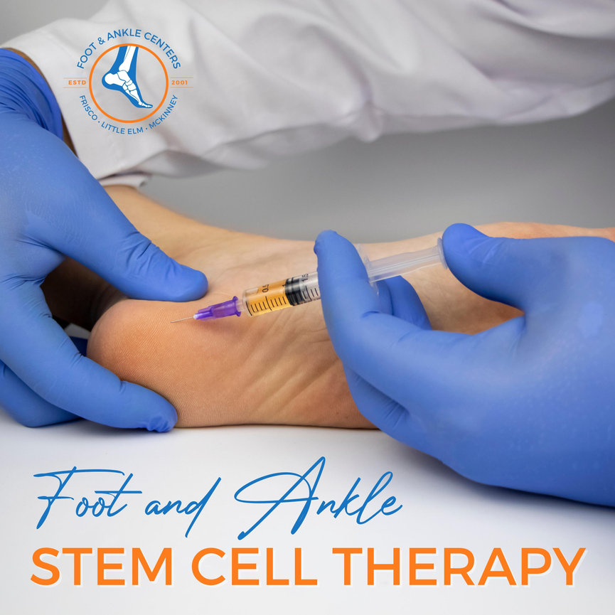 Foot and Ankle Stem Cell Therapy in Frisco, Little Elm, & McKinney