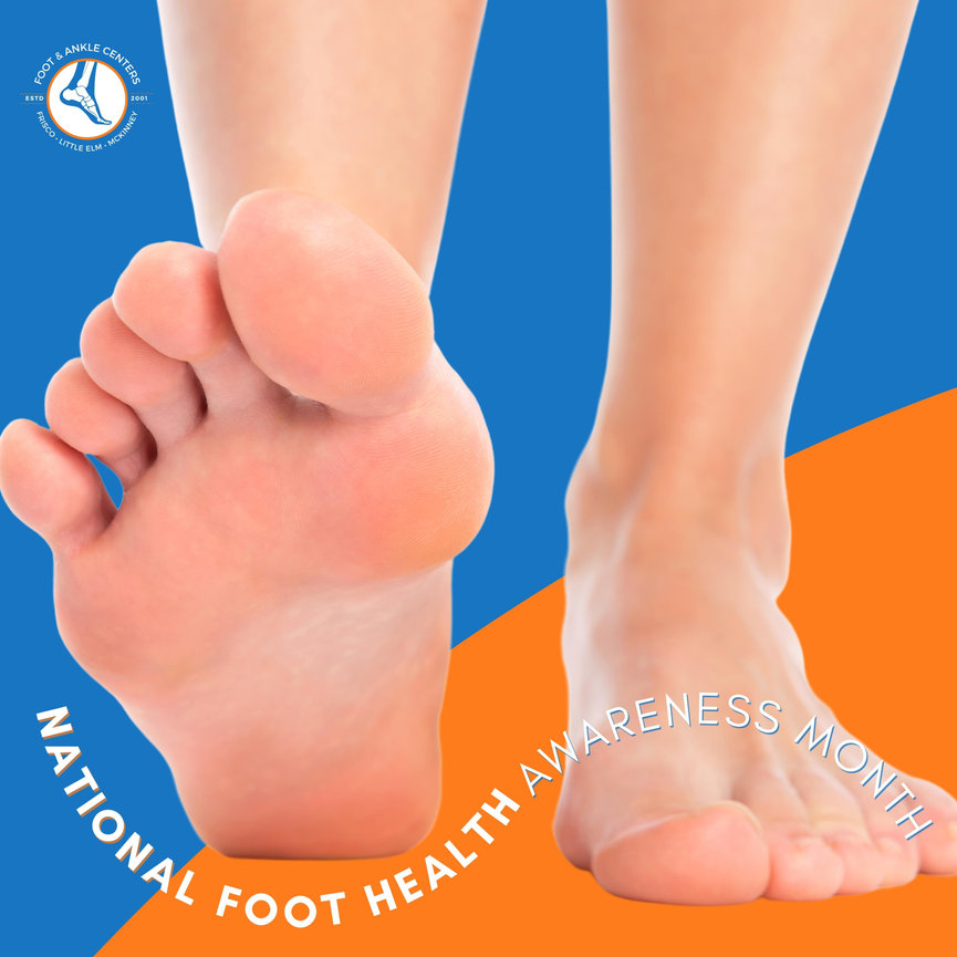 National Foot Awareness Month! Foot & Ankle Centers of Frisco and Plano