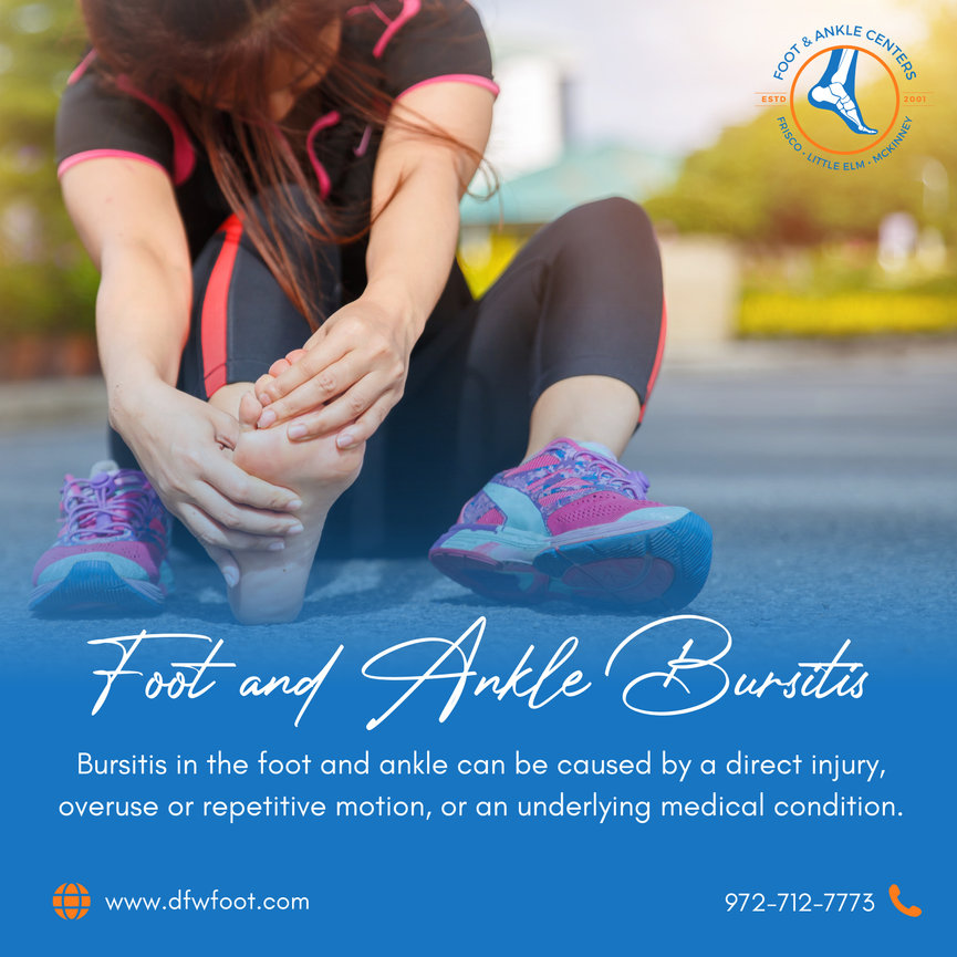 What Causes Foot and Ankle Bursitis? - Foot & Ankle Centers of Frisco ...