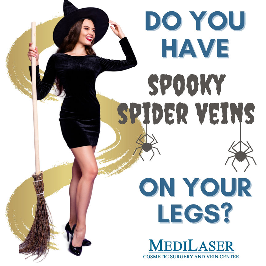Spider Vein Treatment, Medilaser Vein Center